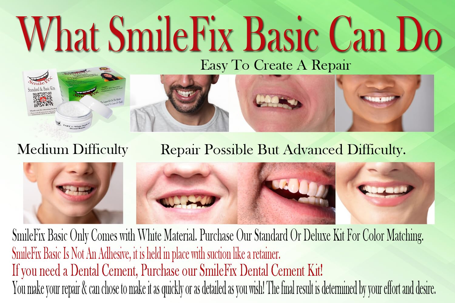 SmileFix perlas termoplásticas dentales ofrecen fijación estable