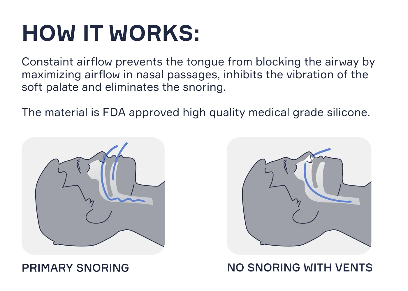 Snore Bastion dilatadores nasales grandes: aptos para hombres y mujeres.
