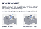 Snore Bastion dilatadores nasales grandes: aptos para hombres y mujeres.