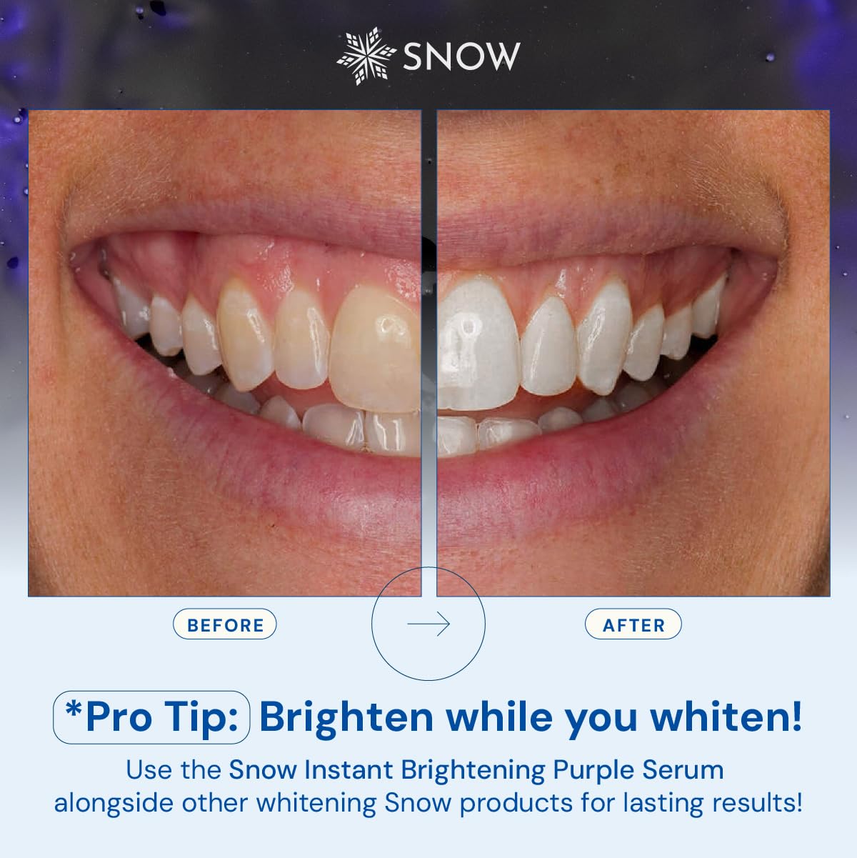 SNOW Teeth Brightening Purple Serum promete durabilidad de 60 días con uso diario.