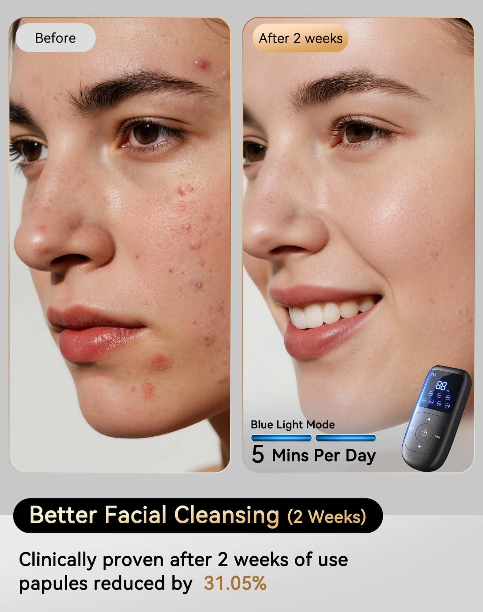 Sobetuar mascarilla LED 4D, tratamiento facial que mejora textura de piel