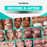 SUNATORIA polvo para dientes sensibles, rutina suave de pulido