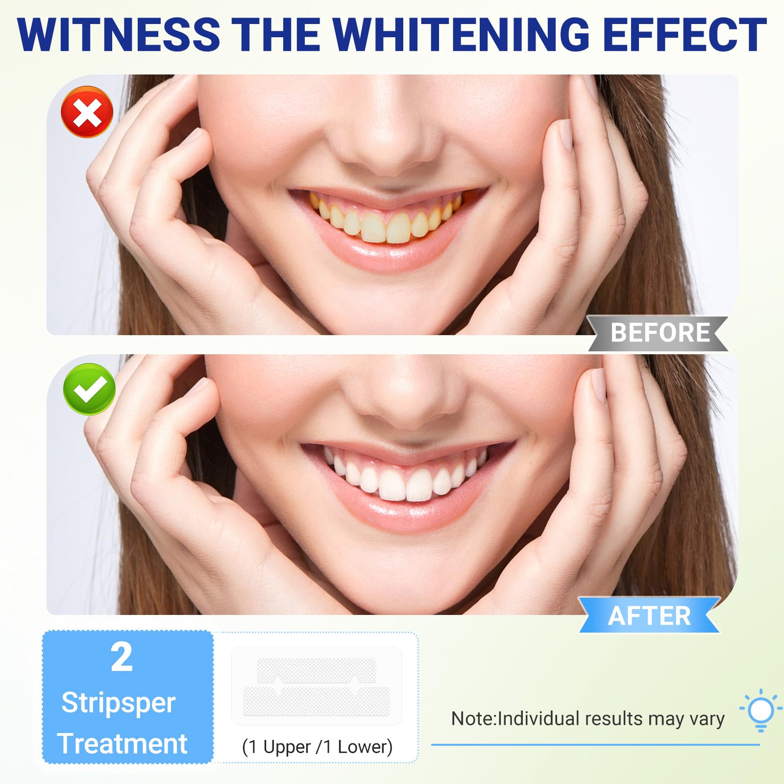 Sundpik tiras blanqueamiento dientes baja irritación protege el esmalte durante el tratamiento