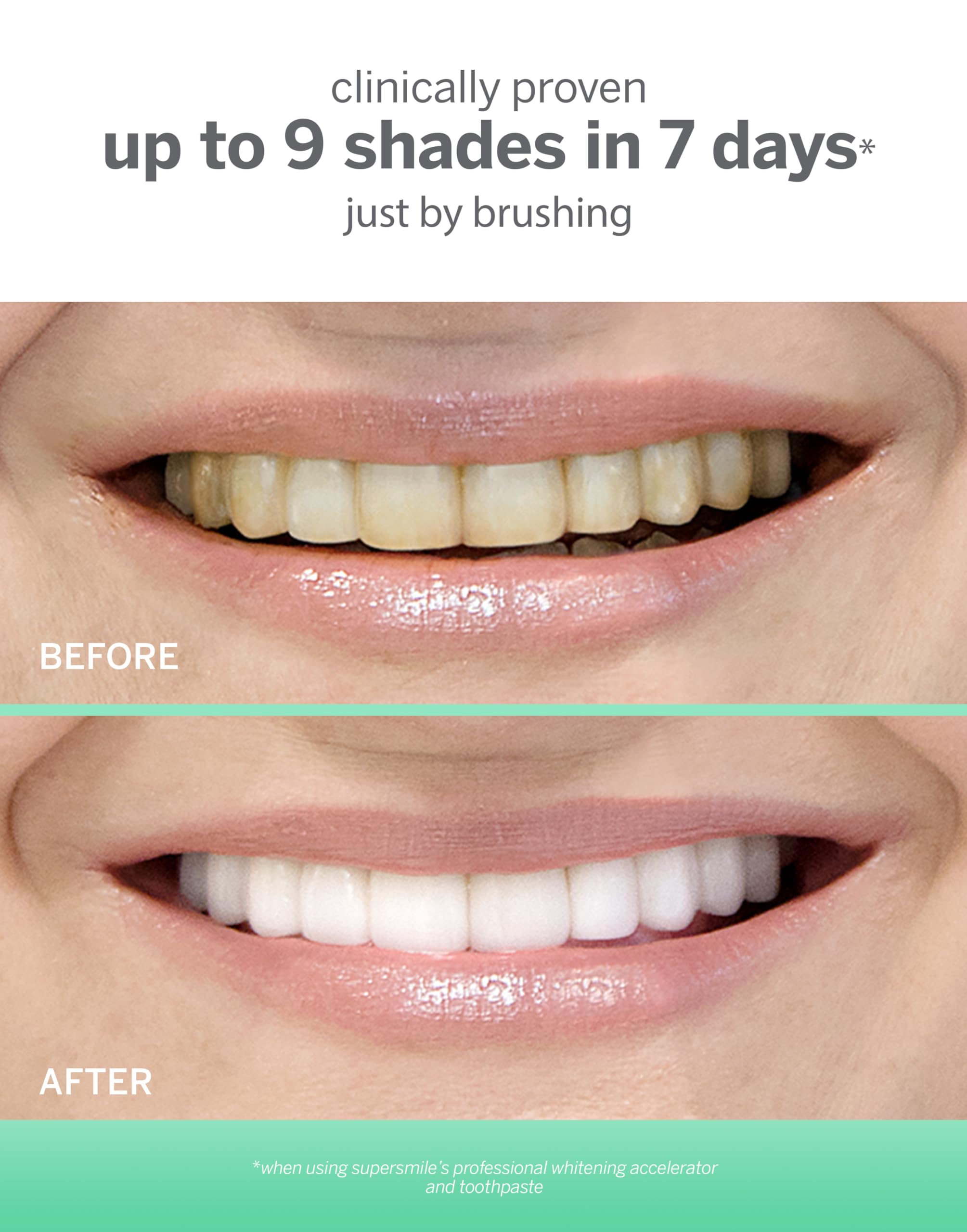 Supersmile aplicación cepillo, facilita una limpieza diaria precisa.
