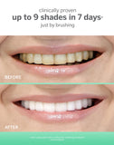 Supersmile aplicación cepillo, facilita una limpieza diaria precisa.