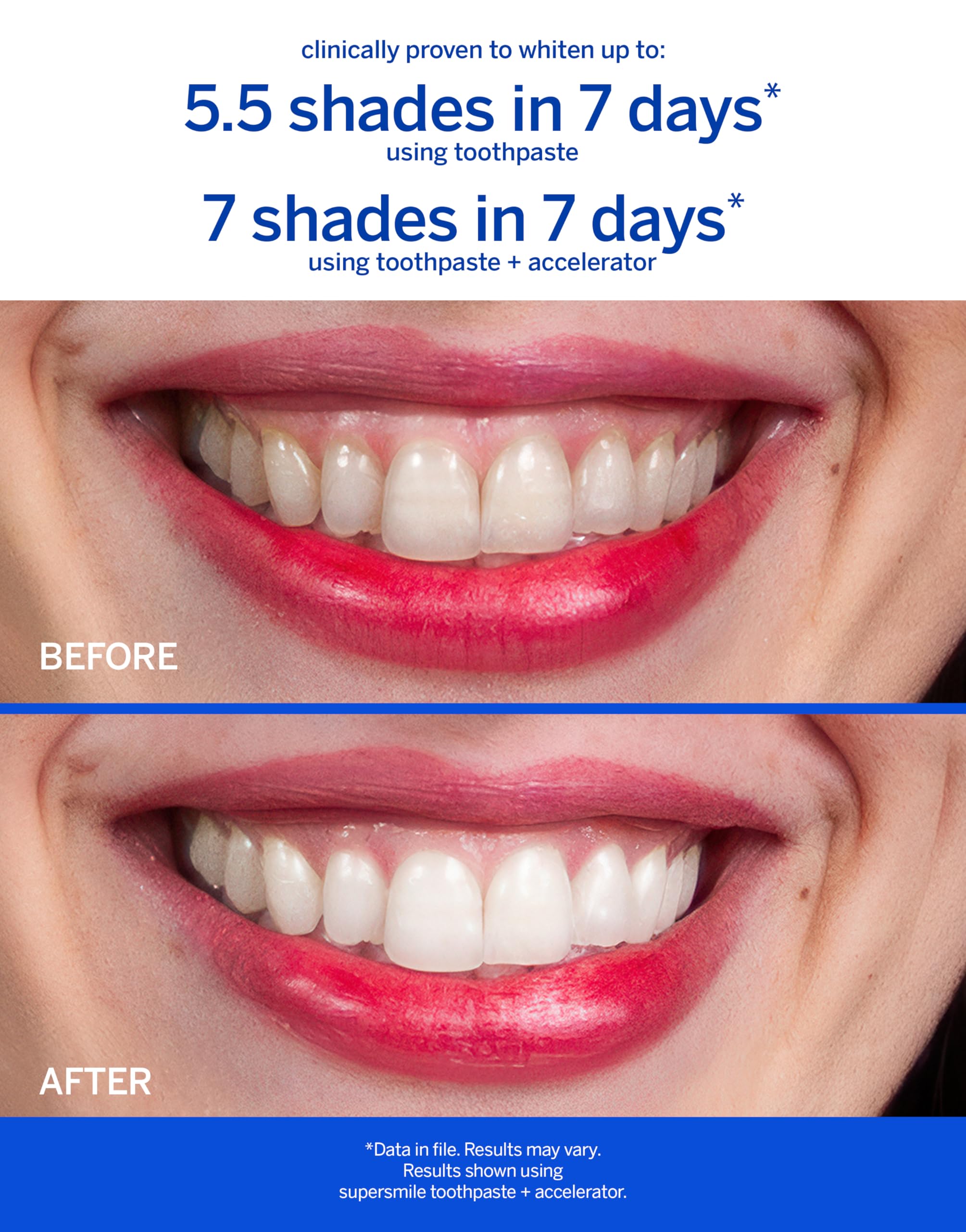 Primer plano de textura cremosa de Supersmile, crema dental libre de fluoruro para cepillado suave.