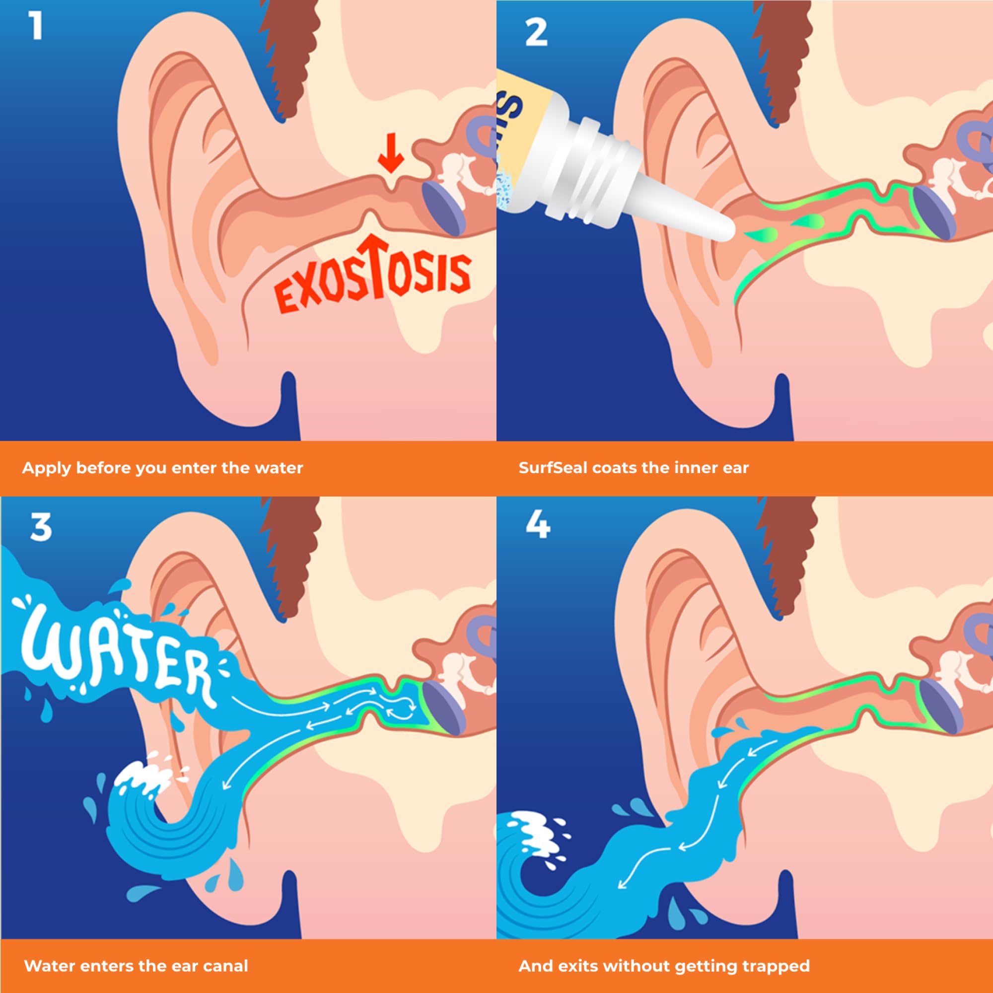 SwimSeal: aplicación de 2-3 gotas en la oreja para uso rápido antes de nadar.