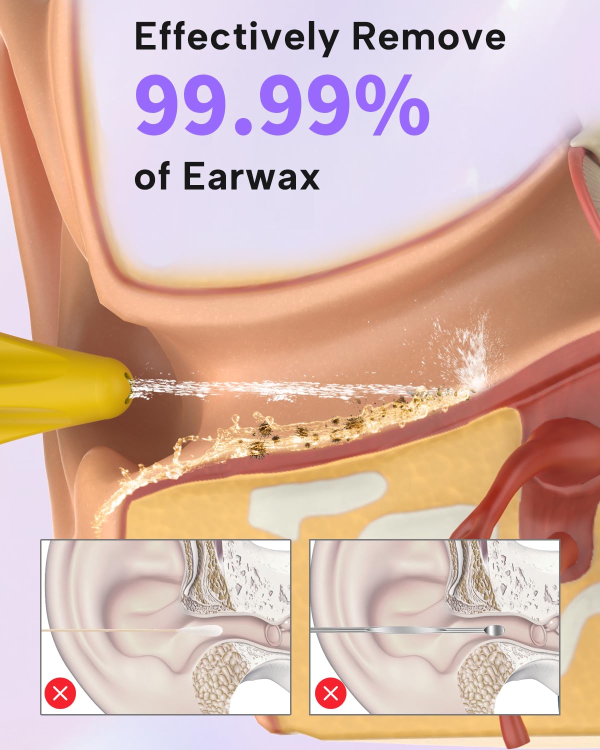 Sylvanthos cerumen-remocion-4-modos ajusta la intensidad para la higiene.