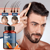 Beneficios de Talyvoriathor DHT Blocker en cápsulas líquidas para cabello saludable.