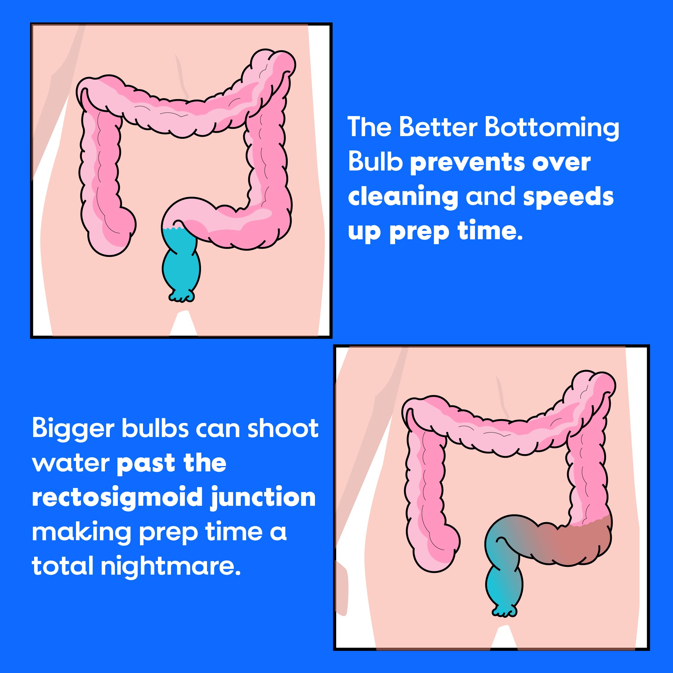 Punta blanca de 6 cm de Bottom’s Digest para introducción controlada.