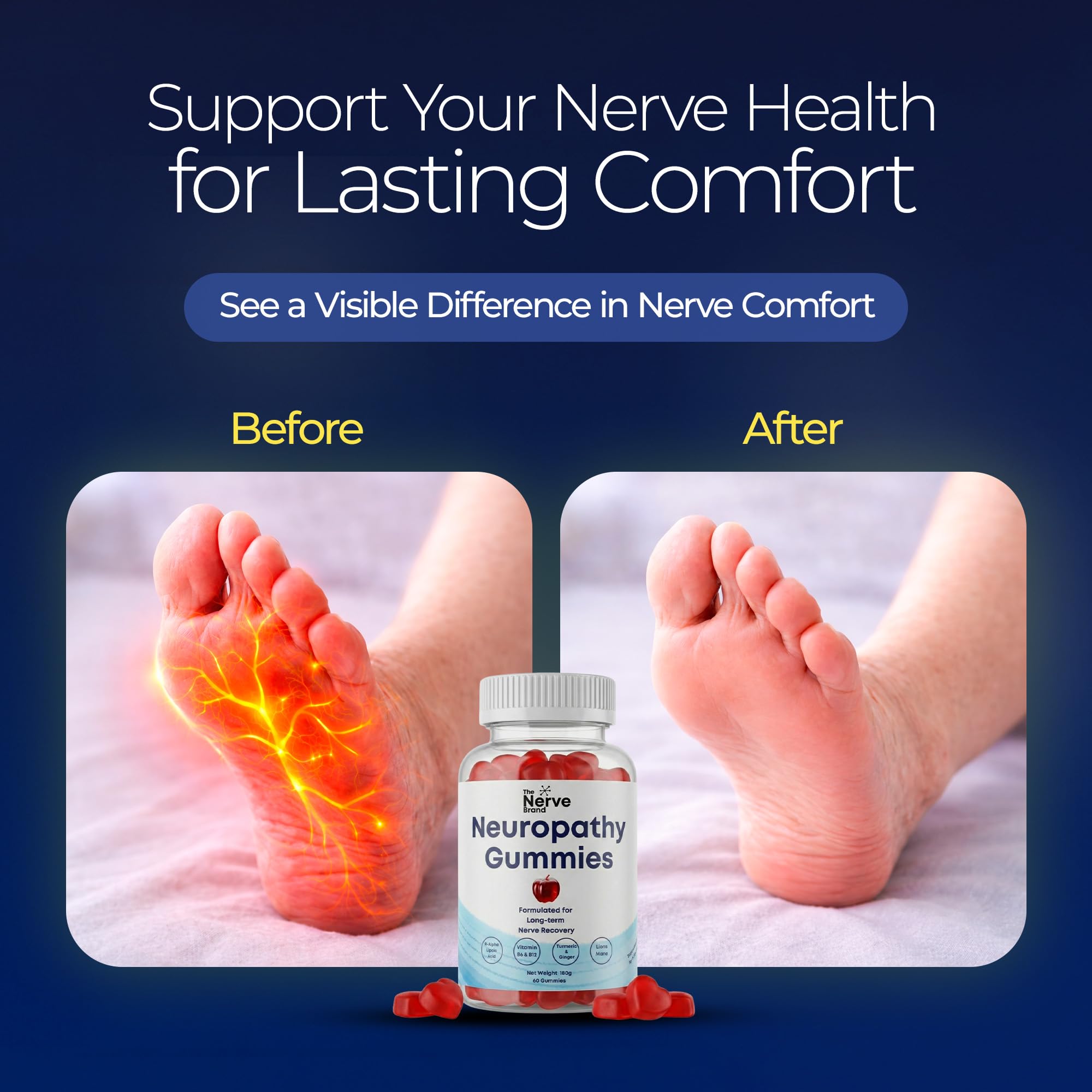 The Nerve Brand gomitas con B1 B6 B12, frasco, beneficios para nervios y energía.