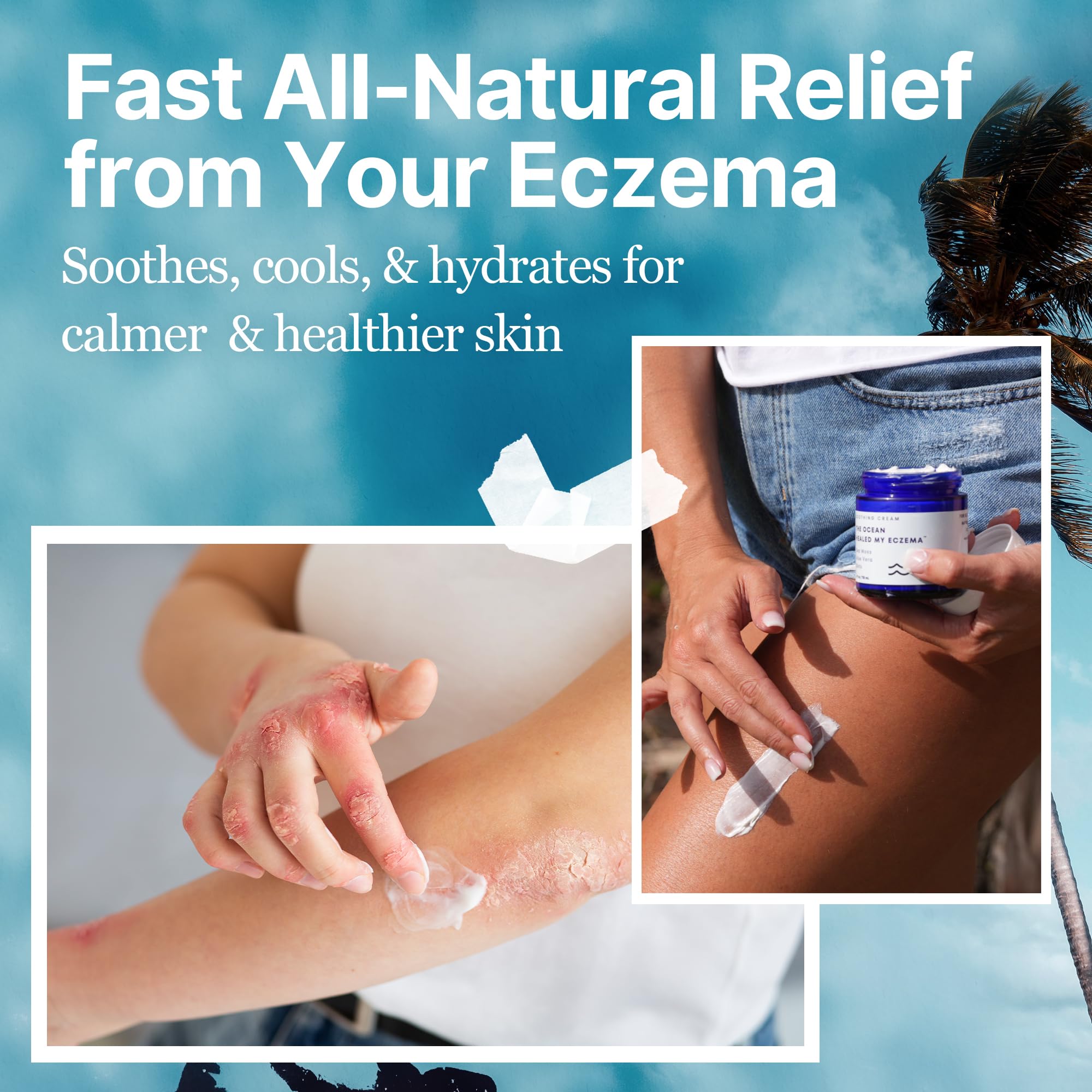 The Ocean Healed My Eczema: aplicacion-rostro-cuerpo para uso diario suave.