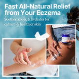 The Ocean Healed My Eczema: aplicacion-rostro-cuerpo para uso diario suave.