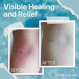 The Ocean Healed My Eczema: envase-sostenible y marca de confianza.