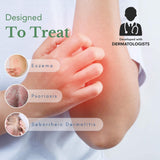 Theraplex AIM crema anti-picor, textura suave y rápida absorción