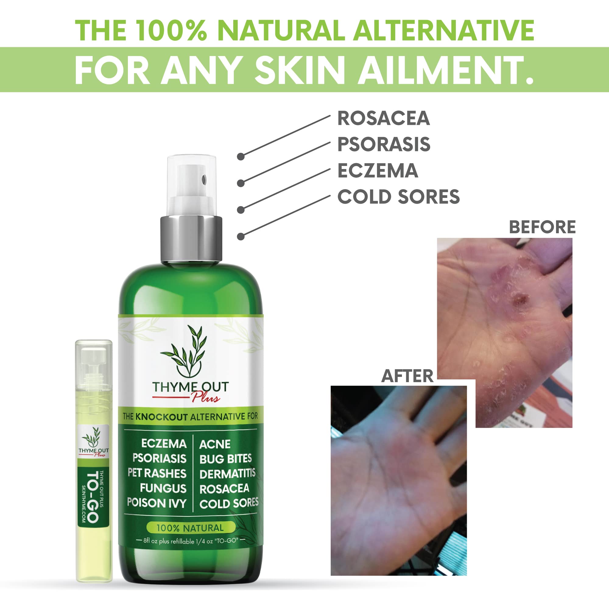 Thyme Out Plus con aloe y tomillo para calmar irritaciones de la piel.