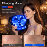 Tiyeaud máscara LED rostro-cuello luz azul para revitalizar la piel.