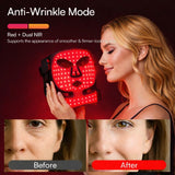 Tiyeaud máscara LED rostro-cuello luz roja para tratamiento suave.