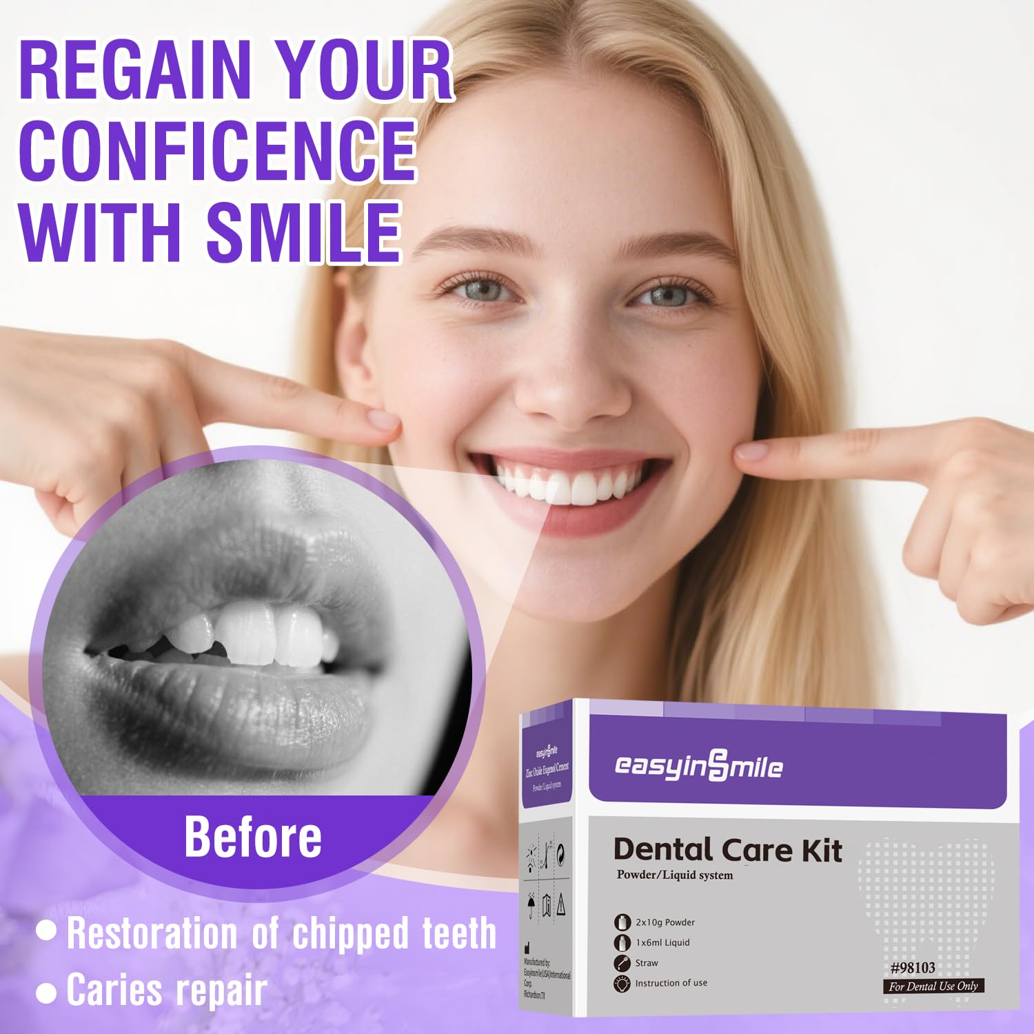 TOPYGOEE cemento dental para reparación temporal, protege el diente dañado.