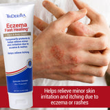 TriDerma crema para dermatitis atópica aplicación en mano con absorción rápida