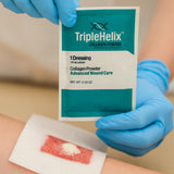 Aplicación en herida con Triple Helix Colágeno en polvo facilita colocación
