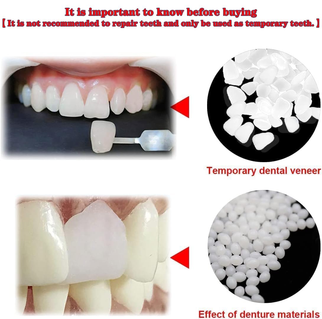 VEZE Kit: reparación de dientes provisionales para uso casero fácil