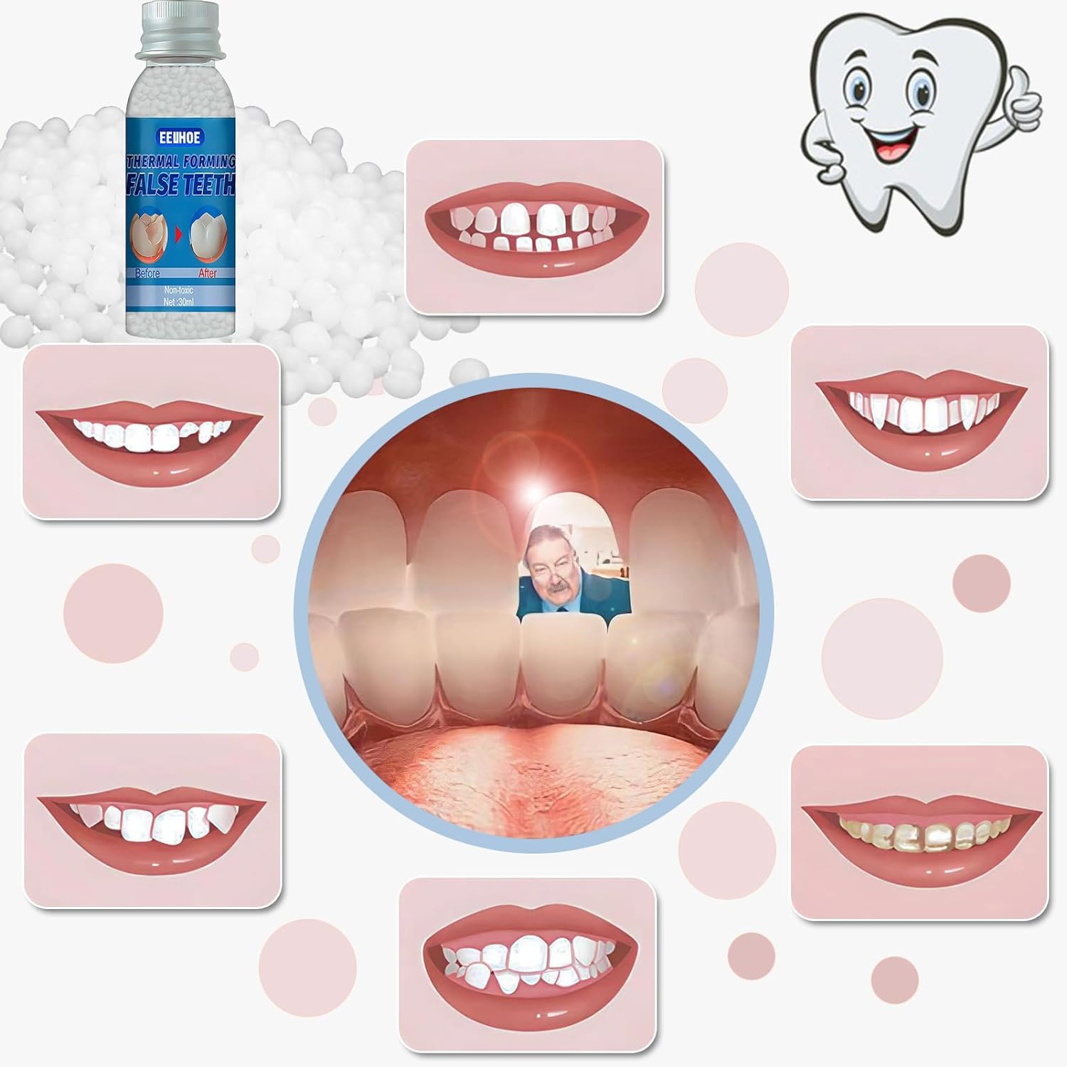 VEZE modelo de dientes provisionales, moldeado en casa para sonrisa temporal.