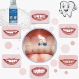 VEZE modelo de dientes provisionales, moldeado en casa para sonrisa temporal.