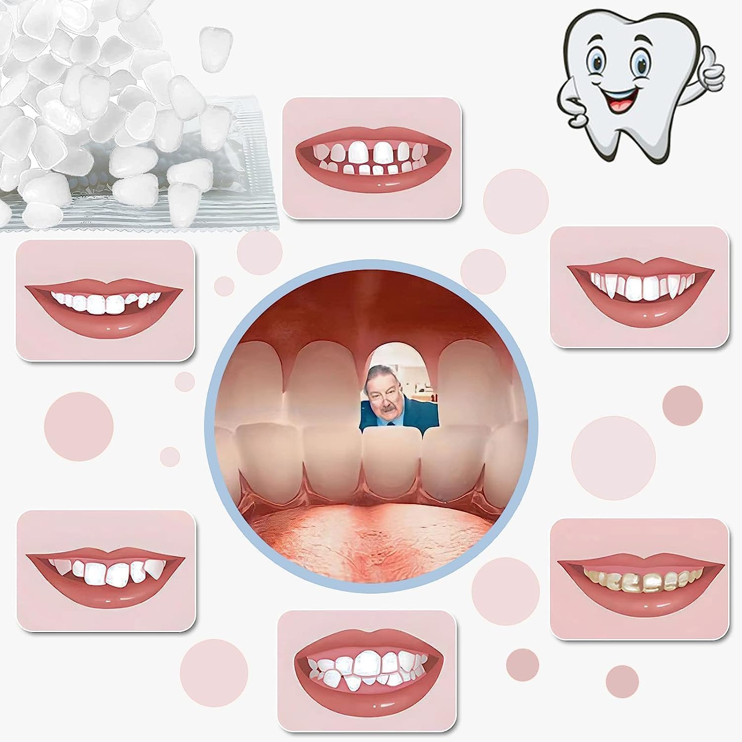 VEZE Perlas termoformables dentales para modelar dientes provisionales