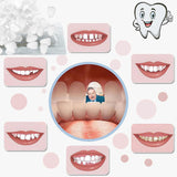 VEZE Perlas termoformables dentales para modelar dientes provisionales