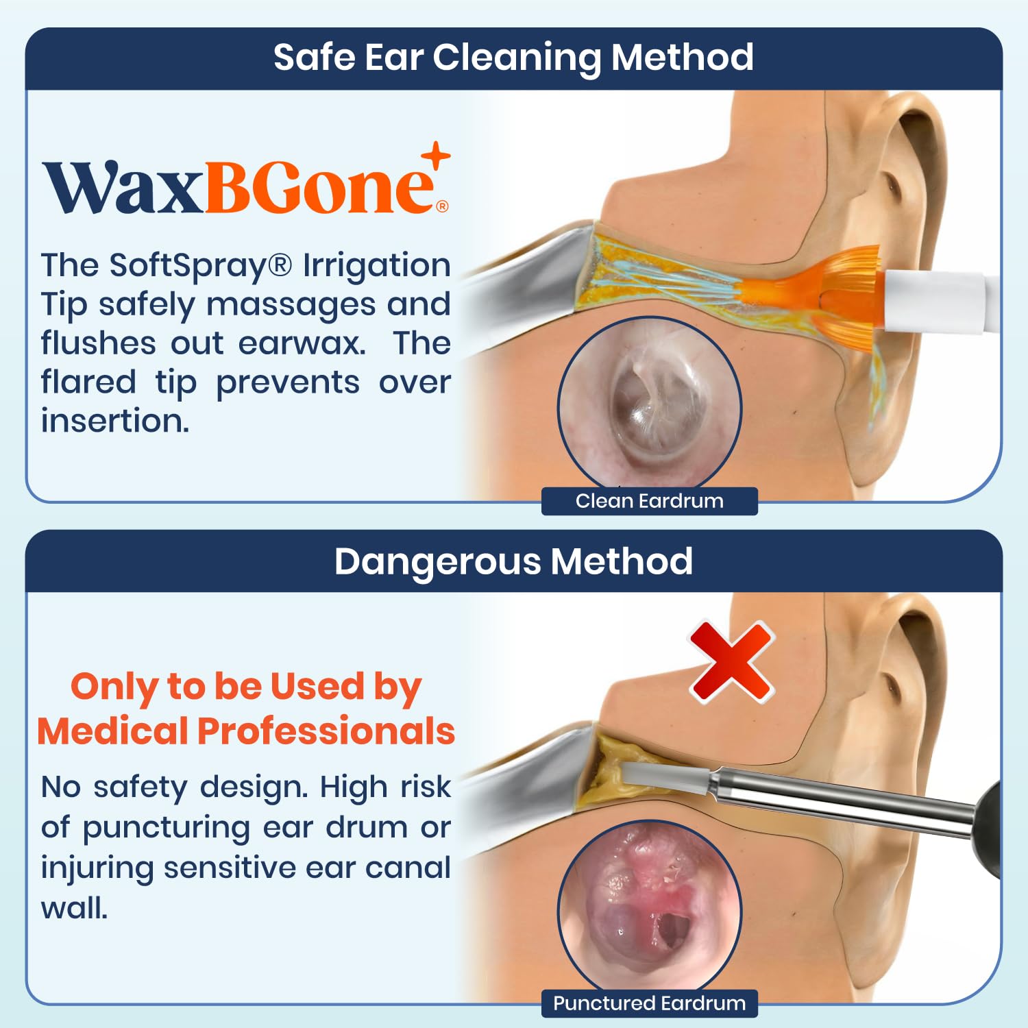 WaxBGone uso domestico oídos, apto para adultos y niños.
