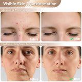 WAYCOM cobertura facial densa para sesiones en casa.