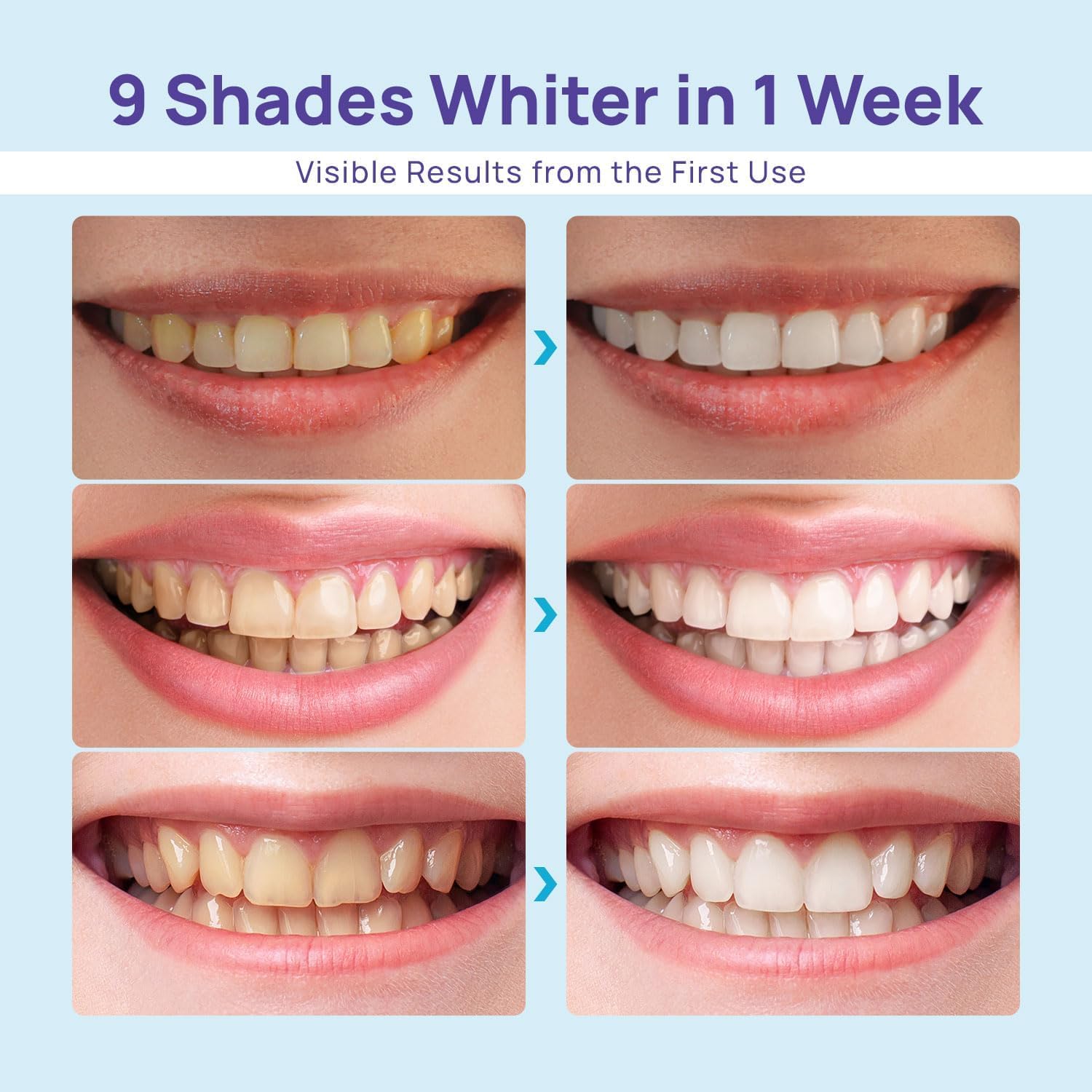 Whitebite Pro luz azul de activación para acelerar manchas en casa