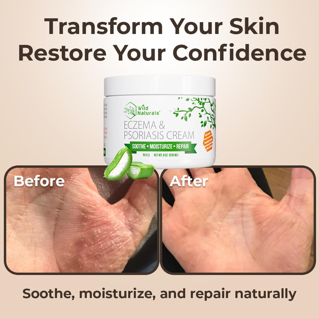 Wild Naturals aplicación en manos para hidratación diaria.