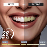 Tubo Woadee pasta dental con nano-hidroxiapatita para remineralización suave.