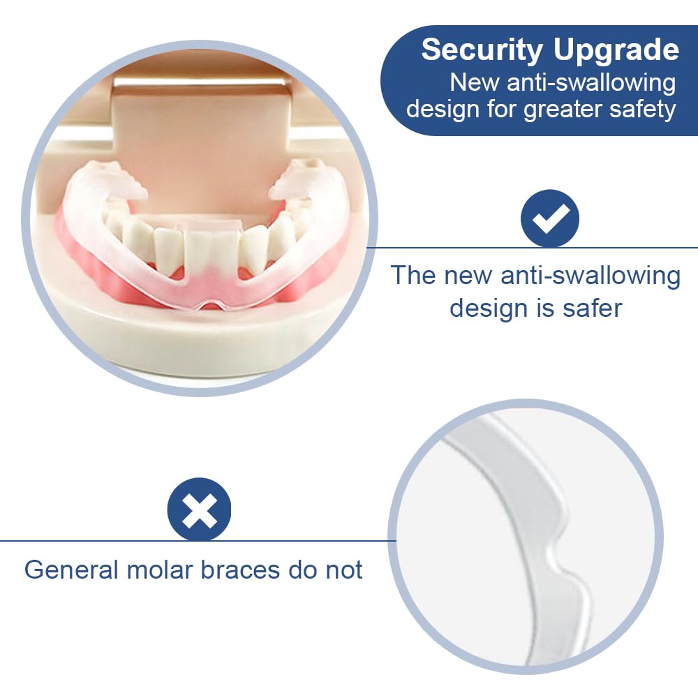 Wokyo ajuste universal para arcos dentales variados durante la noche