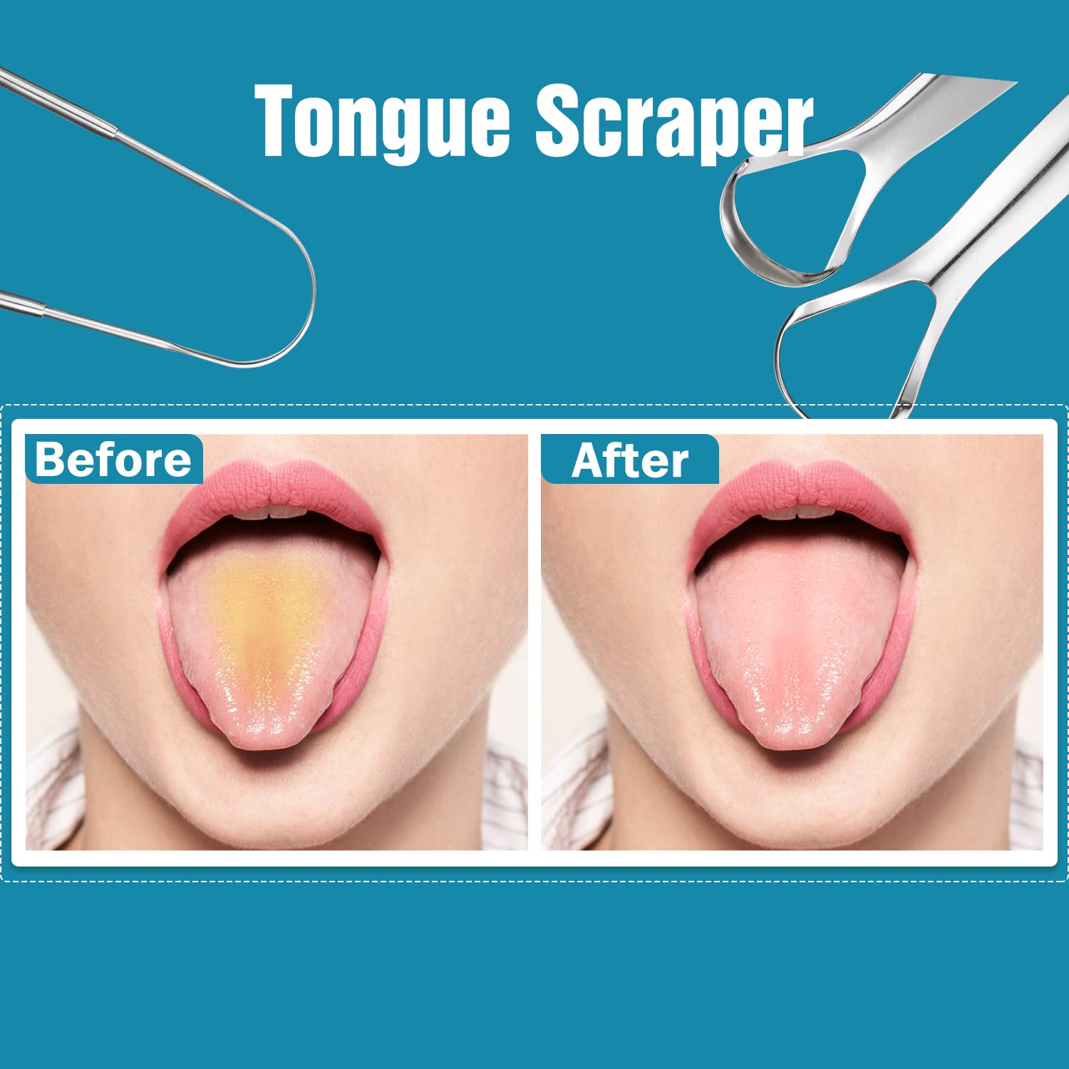 Raspador de lengua YLYL en acero inoxidable, duradero y fácil de limpiar.