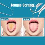 Raspador de lengua YLYL en acero inoxidable, duradero y fácil de limpiar.