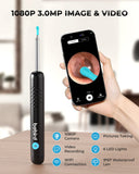 Yumika R1, otoscopio inalámbrico, uso diario sin cables.
