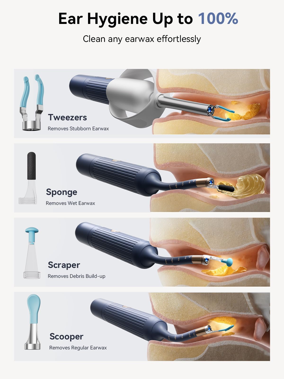 ZERONDER I35R endoscopio-domestico-inalambrico: monitorización en casa sin internet