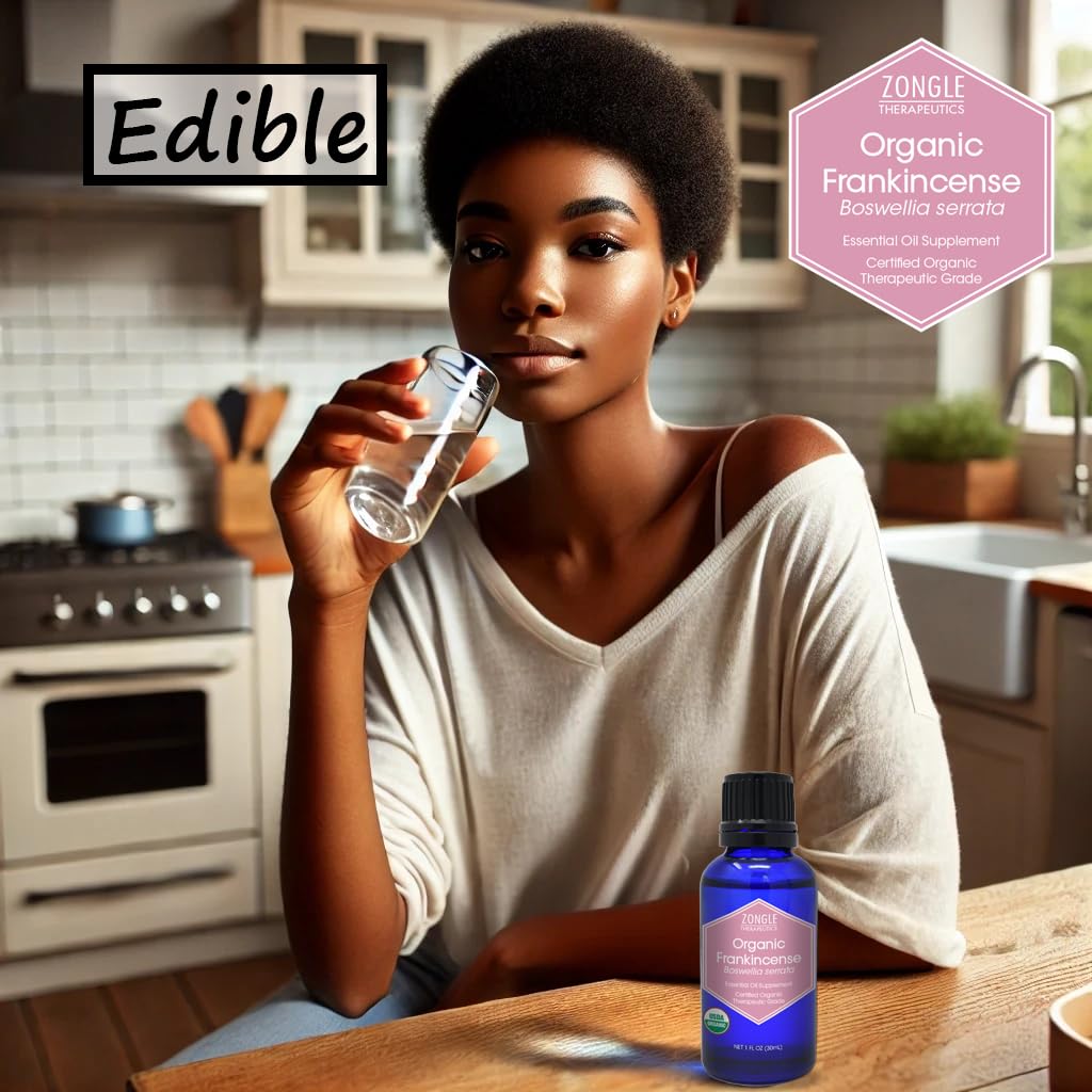 Zongle Therapeutics aceite de incienso para cuidado de la piel.